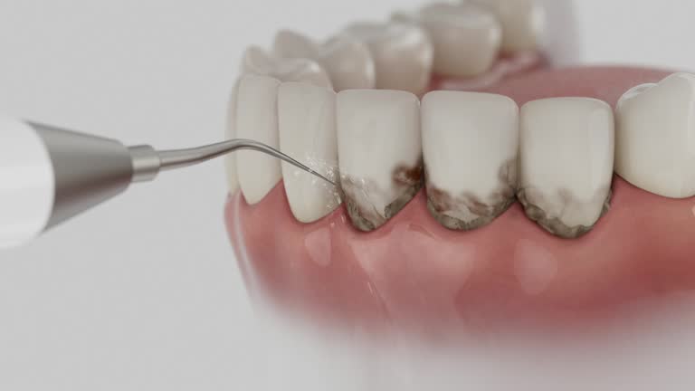 Reliable Emergency Dentist contractor in Melvindale, MI by Smile Center Dentistry